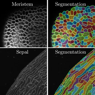 Weakly Supervised Segmentation